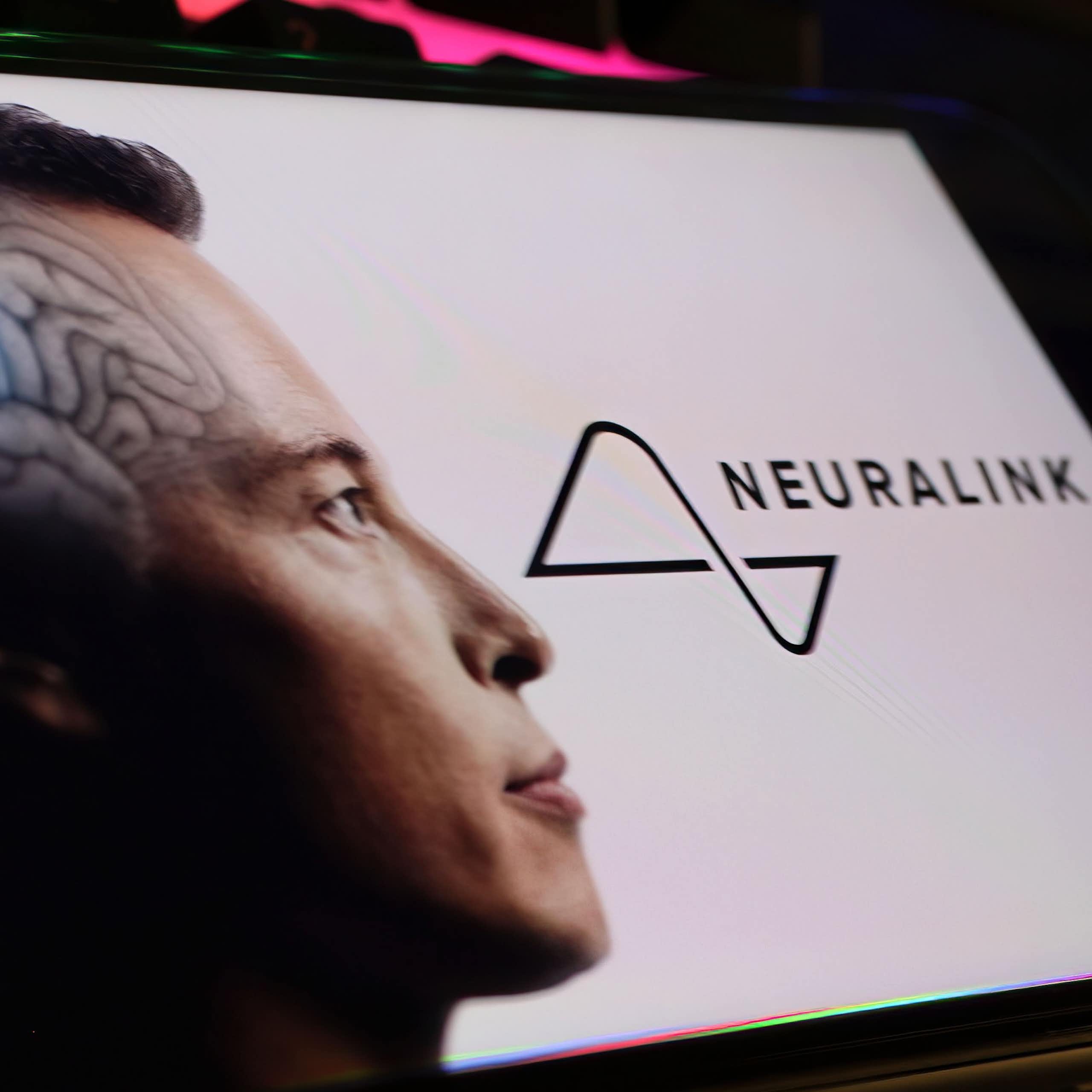 Améliorer l'être humain afin qu'il soit plus performant ? Tel est le projet - néfaste - du transhumanisme