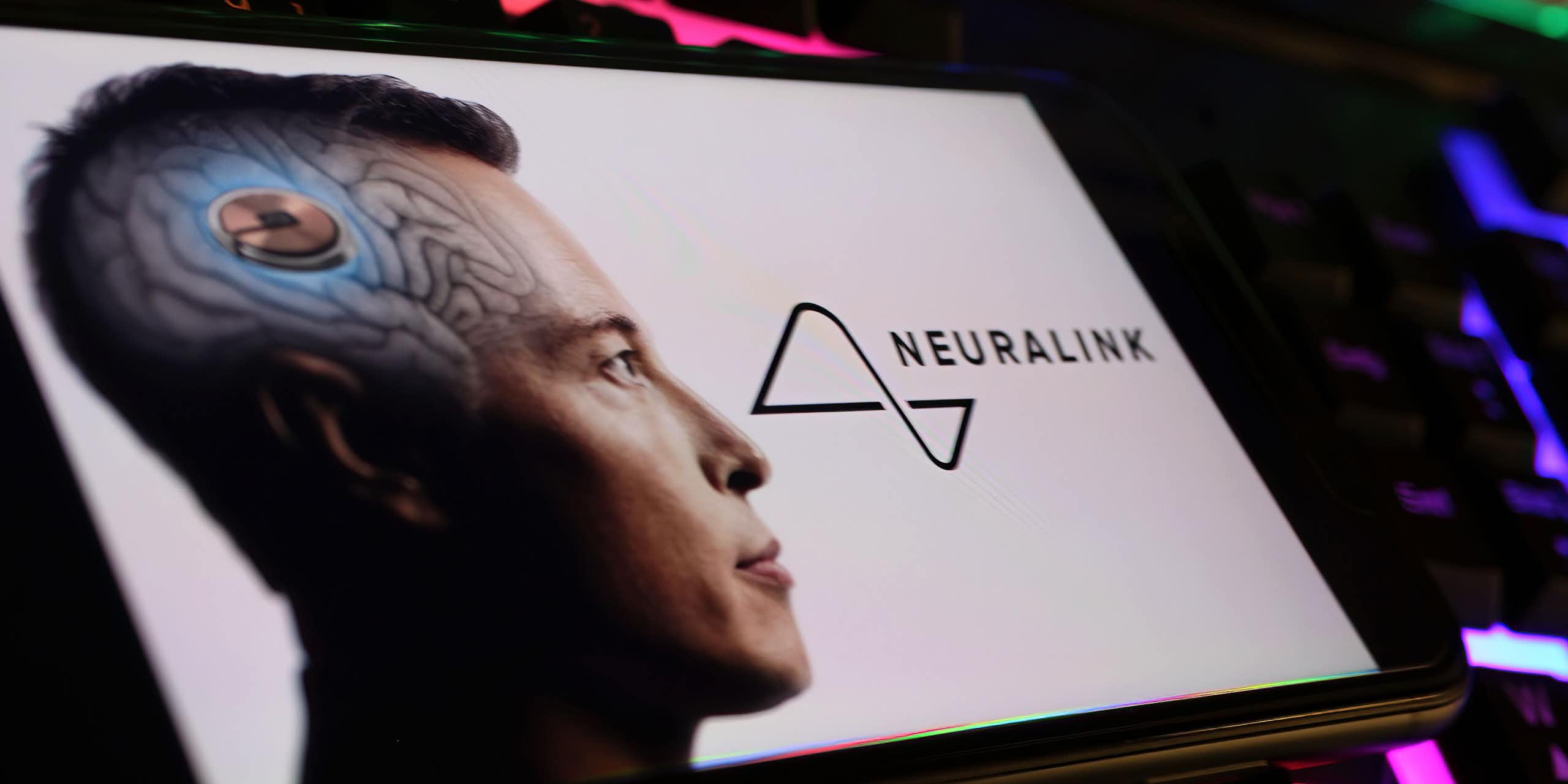 Améliorer l'être humain afin qu'il soit plus performant ? Tel est le projet - néfaste - du transhumanisme