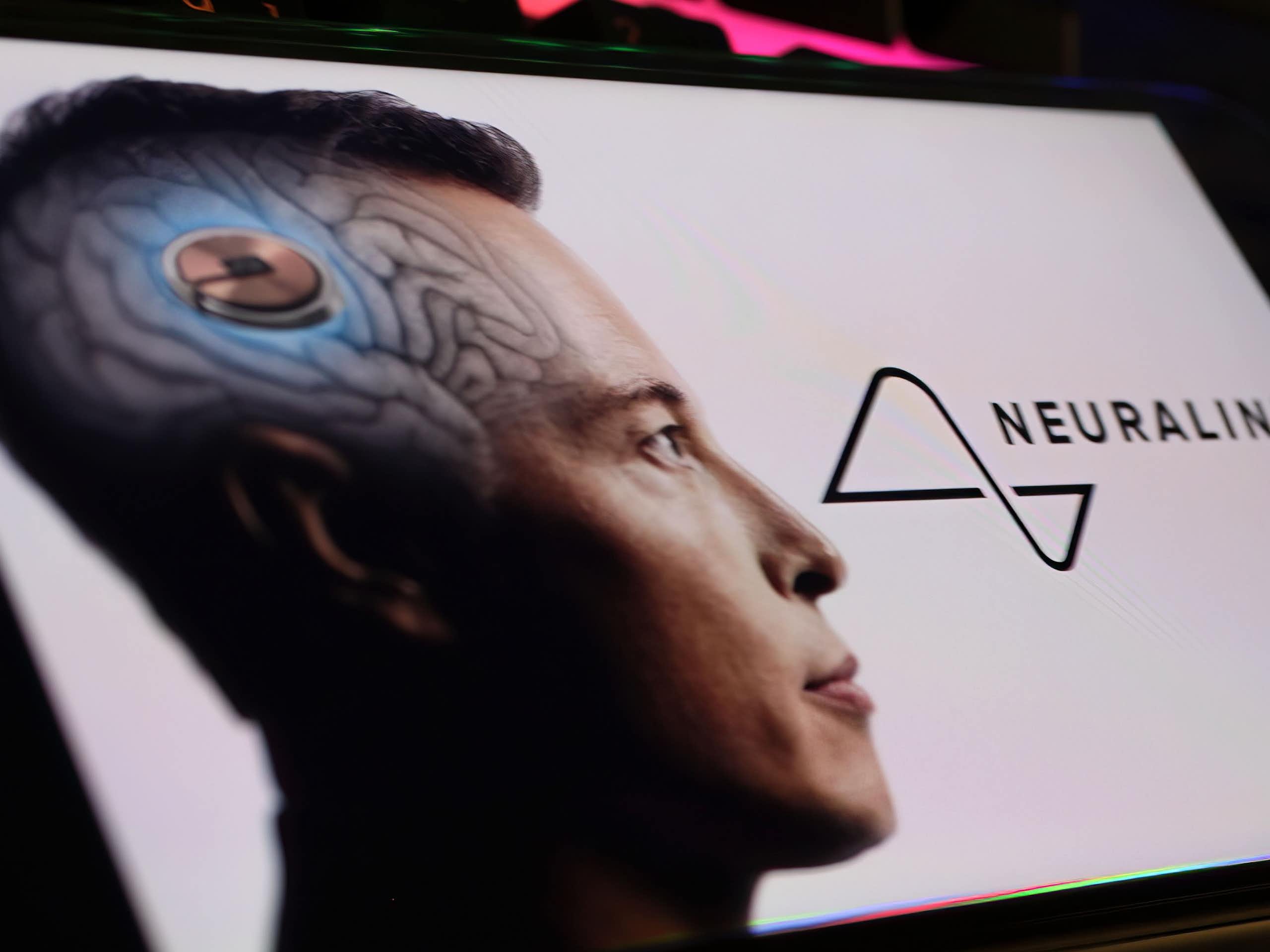 Un homme porte un implant cérébral