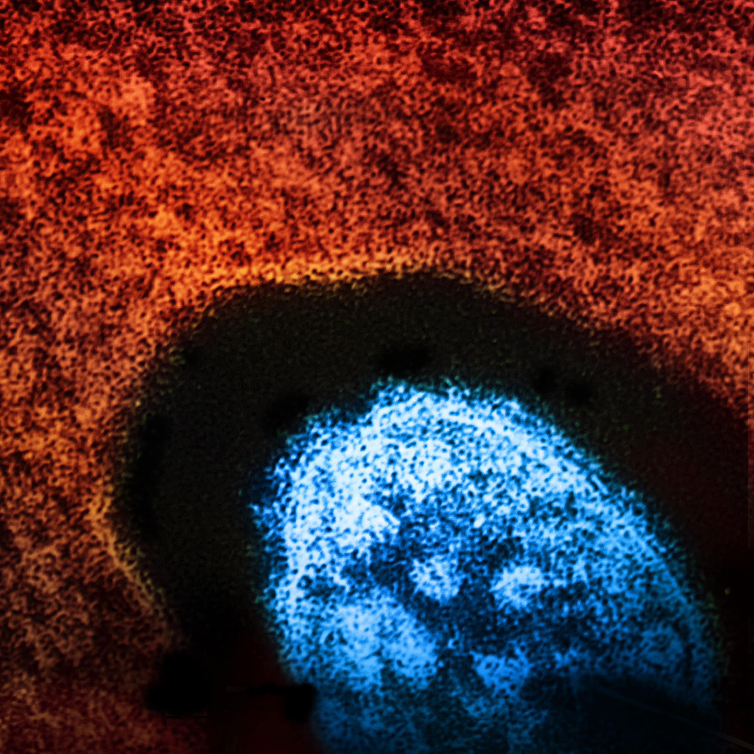 Colourized microscopic view of the measles virus in blue