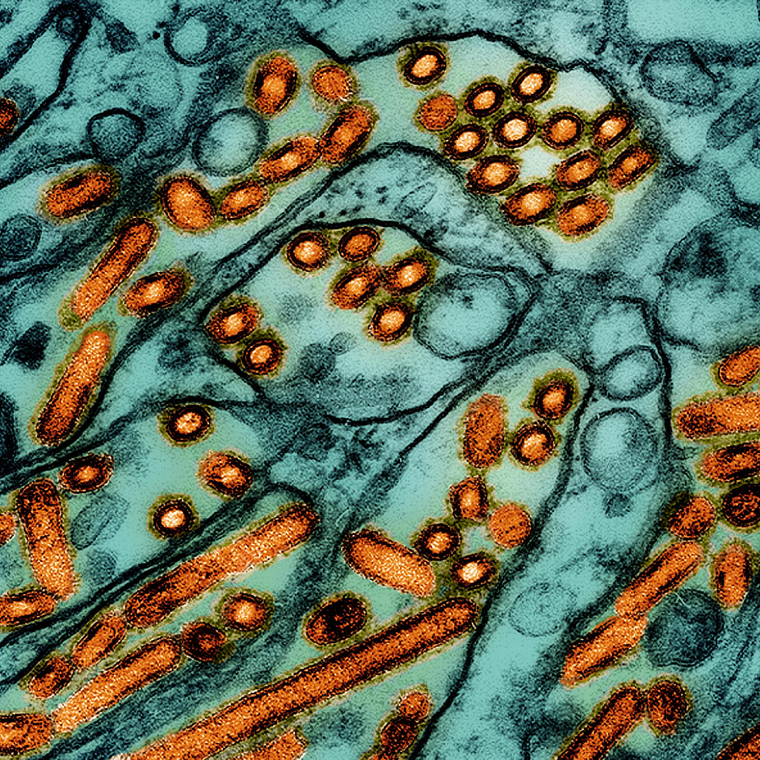 Microscopic view of avian influenza A H5N1 virus particles