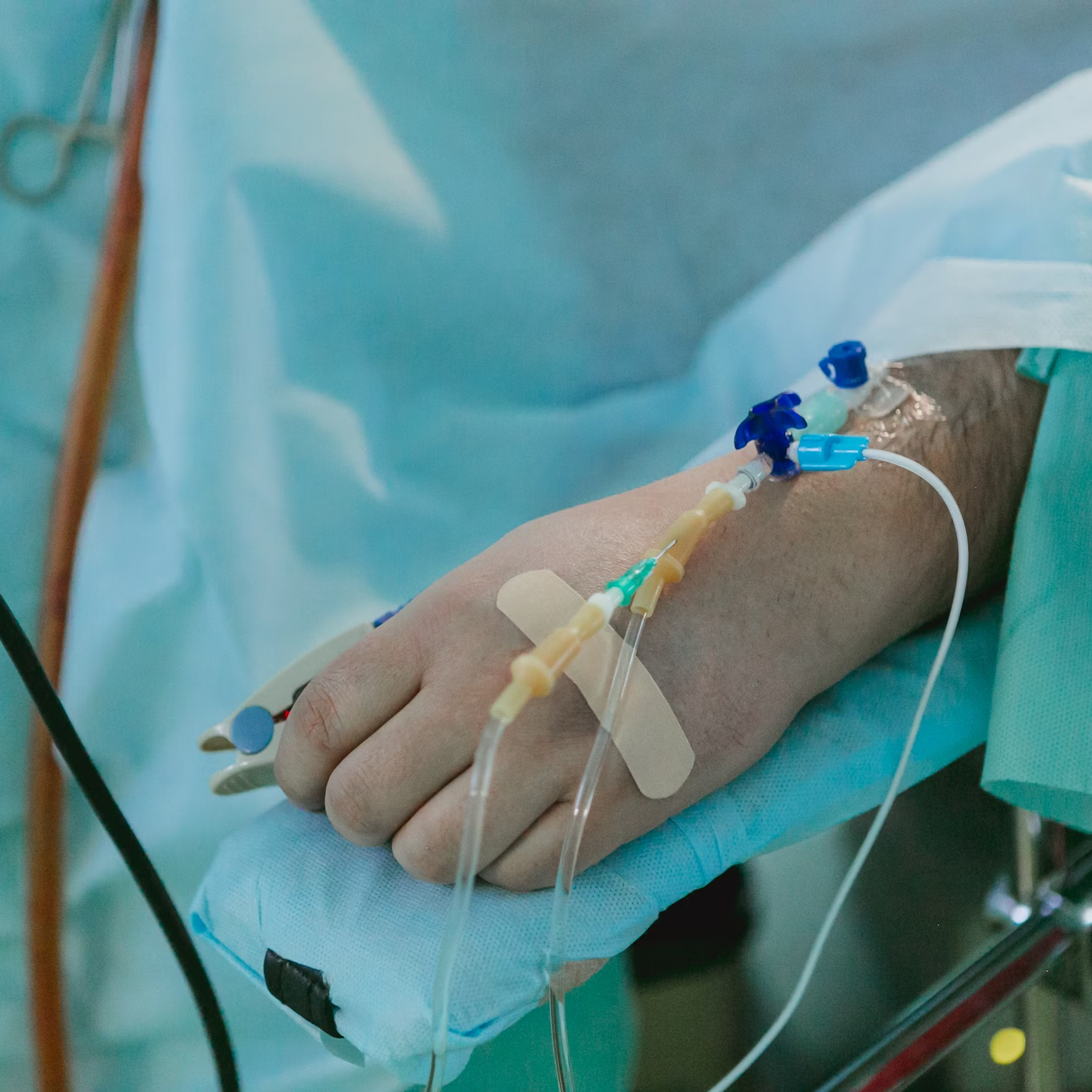 A hand with an intravenous port