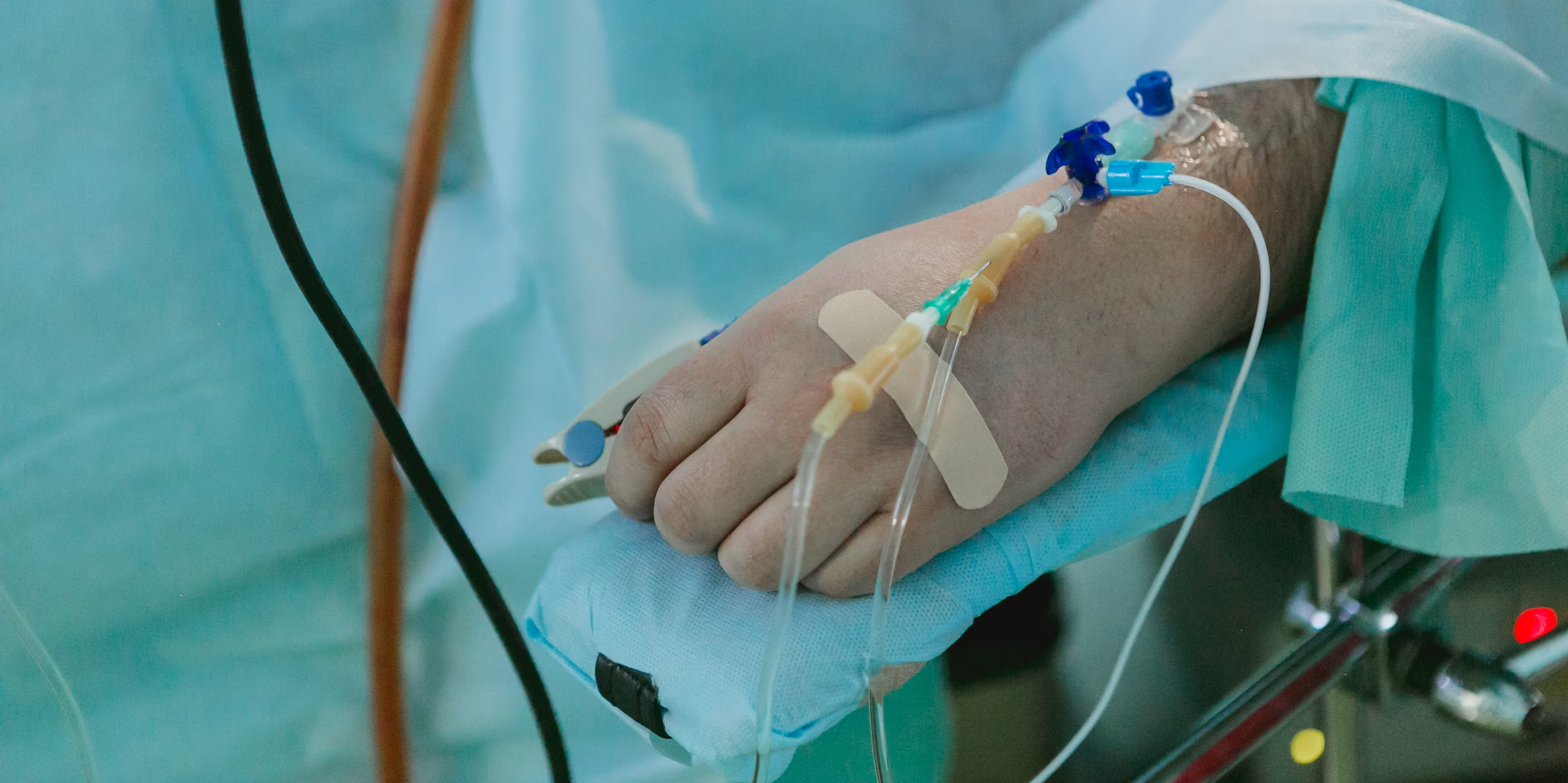 A hand with an intravenous port